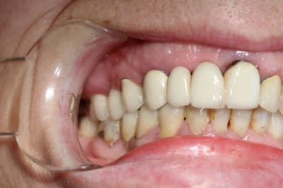 Untitled 2 qsp3by - Eugenol