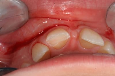 Vrac 444 qymed5 - Eugenol