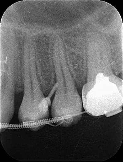 Vis ortho mk5ii5 - Eugenol
