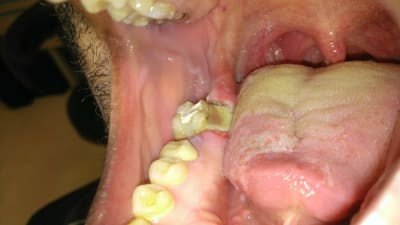 Wp 20130827 001 kbjte5 - Eugenol