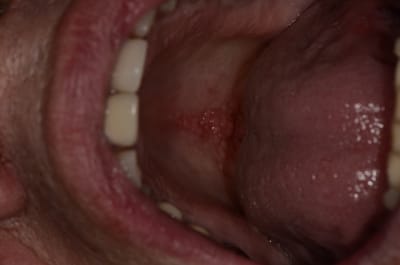  dsc1685 grwsxg - Eugenol