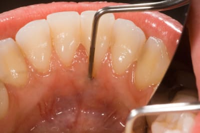  mg 0041 iwulac - Eugenol