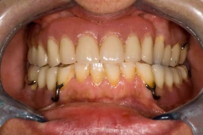  mg 0071 lyuqck - Eugenol