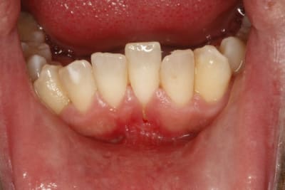  mg 1266  1600x1200  aasnr0 - Eugenol