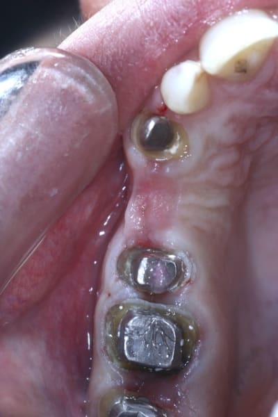  mg 1532 edmoft - Eugenol