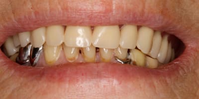  mg 1804 qucnww - Eugenol