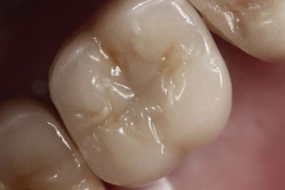  mg 2290 dehjjd - Eugenol