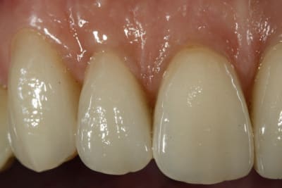  mg 2682 ejnalu - Eugenol