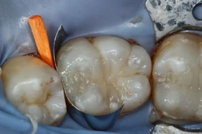  mg 3042 hbyy1o - Eugenol