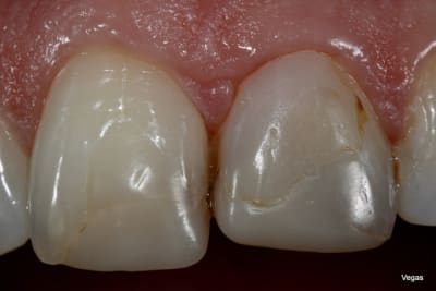  mg 3246 jb7mrx - Eugenol