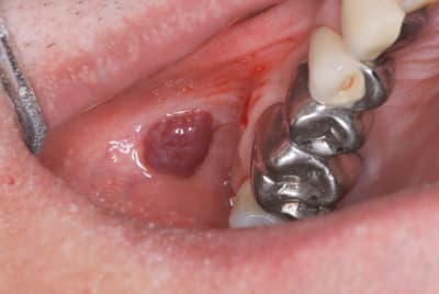  mg 3376 bspf0a - Eugenol