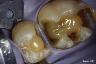  mg 5040 001 d5oemy - Eugenol