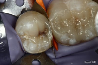  mg 5045 001 nvhmlp - Eugenol