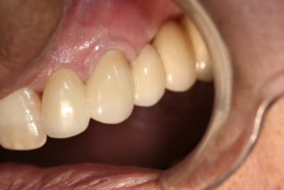  mg 6424 ogmkop - Eugenol