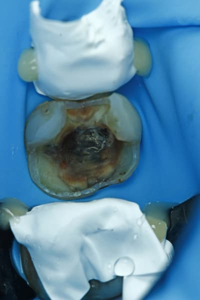  mg 7526 i6pajg - Eugenol