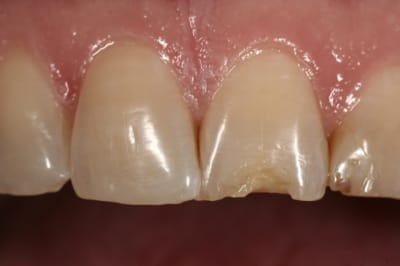  mg 8152 rupzxn - Eugenol