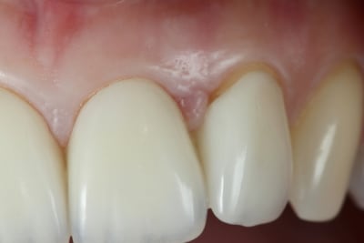  mg 9475 vn2wpf - Eugenol