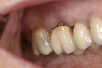  mg 9817   copie wpntdm - Eugenol