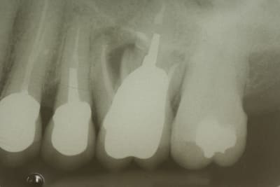  mg 9818   copie wzuscj - Eugenol