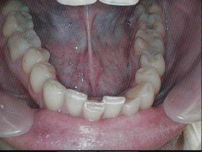  at 00 55 47 156  025 img s  f64hsj - Eugenol