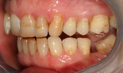  carteur gauche kgjoco - Eugenol