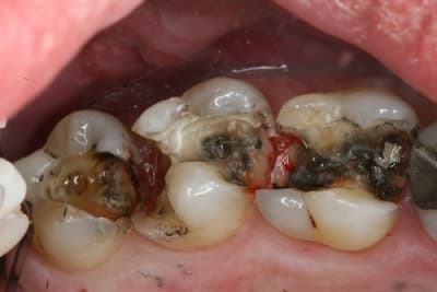  tape 1 hywigq - Eugenol