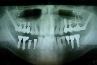 A bientot cm2aoj - Eugenol