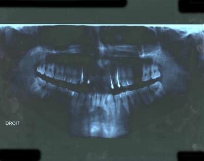 Accident1 ylmd6n - Eugenol