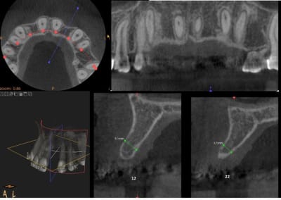 Agenesie n1tsgb - Eugenol