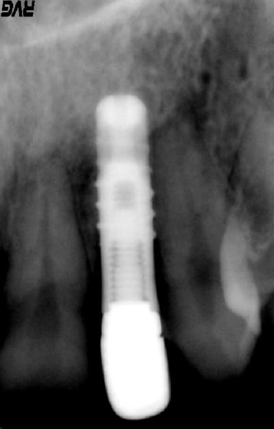 Ahdhwe13nfypxhrs8bra - Eugenol