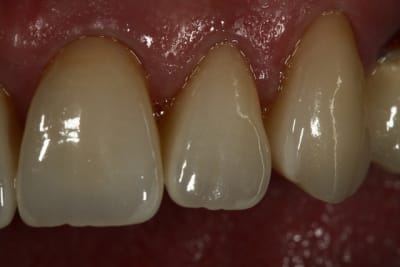 Aie  6  qbyf5b - Eugenol