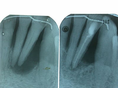 Alveo term ec5jug - Eugenol