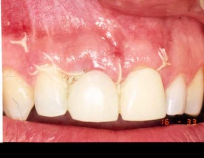 Amant6 luenvo - Eugenol