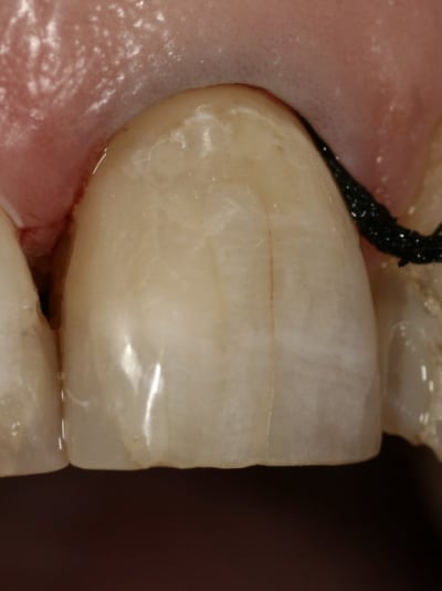 Amaris2 ibxqyr - Eugenol