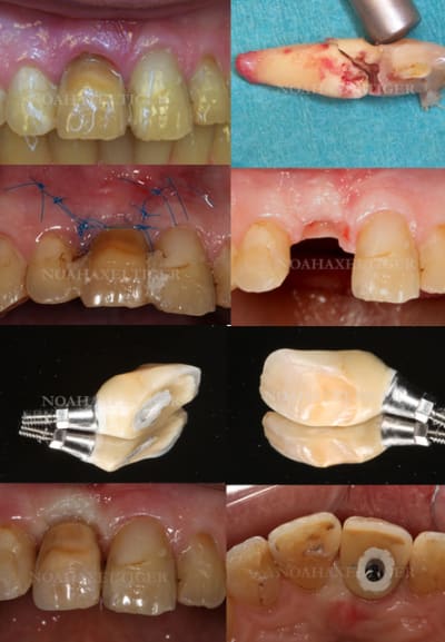 Anders dxjoo0 - Eugenol