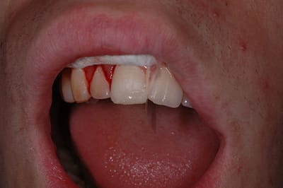 Angletemp k2ayqu - Eugenol