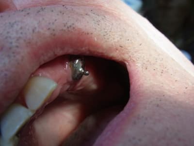 Att3 dcijz7 - Eugenol