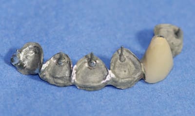 Attelle itq6ck - Eugenol