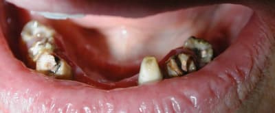 Avant2 goe2kr - Eugenol