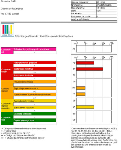 Avant laser umx3aw - Eugenol