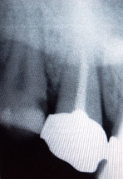 Avant ncu9sf - Eugenol