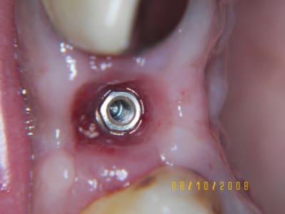 Avec sl2lu7 - Eugenol