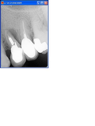 Avis0 ygfj64 - Eugenol