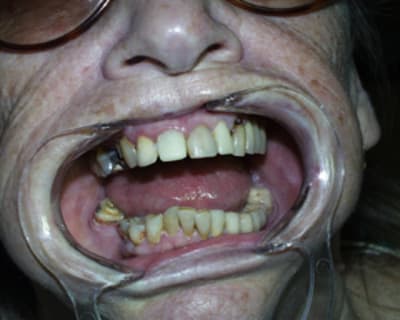 Aya10 gbanqh - Eugenol