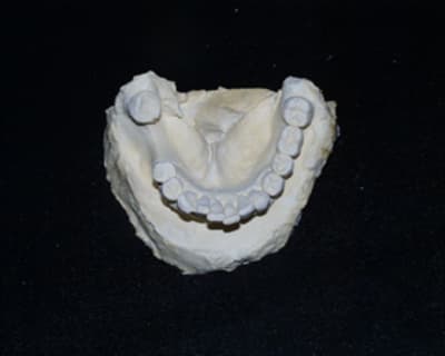 Aya2 ug2bu3 - Eugenol