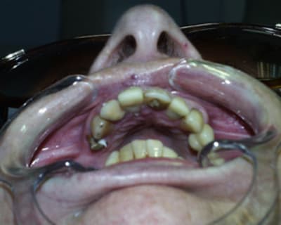 Aya4 zvqrhg - Eugenol