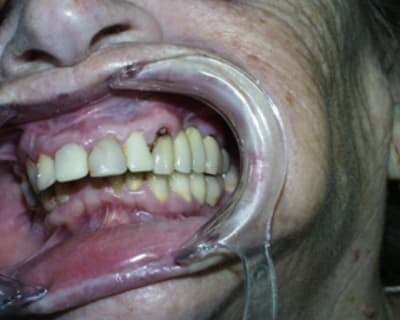 Aya6 ltocvc - Eugenol