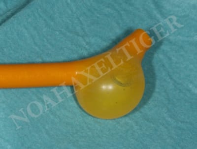 Ballon gonfl  au s rum phy nhxecf - Eugenol