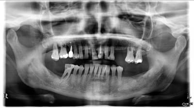 Bayvnpcr3c6ka4yeoltj - Eugenol