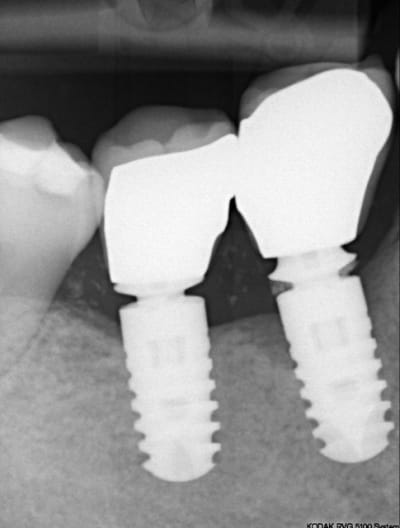 Bofbof nzkpw5 - Eugenol